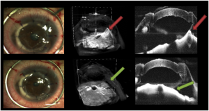 gpu accelerated optical coherence tomography